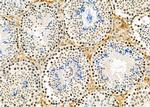 SMYD3 Antibody in Immunohistochemistry (Paraffin) (IHC (P))