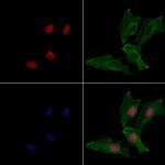 SNAIL Antibody in Immunocytochemistry (ICC/IF)