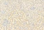 SNAIL Antibody in Immunohistochemistry (Paraffin) (IHC (P))