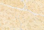 SNAIL Antibody in Immunohistochemistry (Paraffin) (IHC (P))