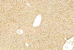 SNAIL Antibody in Immunohistochemistry (Paraffin) (IHC (P))