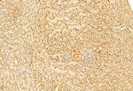 SNAIL Antibody in Immunohistochemistry (Paraffin) (IHC (P))