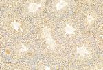 SNAIL Antibody in Immunohistochemistry (Paraffin) (IHC (P))