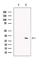 SNAIL Antibody in Western Blot (WB)