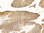 SNX6 Antibody in Immunohistochemistry (Paraffin) (IHC (P))