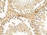 SNX6 Antibody in Immunohistochemistry (Paraffin) (IHC (P))