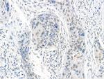 SON Antibody in Immunohistochemistry (Paraffin) (IHC (P))