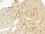 SON Antibody in Immunohistochemistry (Paraffin) (IHC (P))