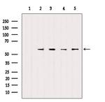 SOX9 Antibody in Western Blot (WB)