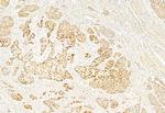 SP1 Antibody in Immunohistochemistry (Paraffin) (IHC (P))