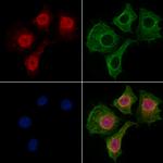 SPT6 Antibody in Immunocytochemistry (ICC/IF)