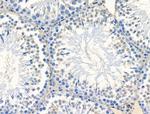 SPT6 Antibody in Immunohistochemistry (Paraffin) (IHC (P))