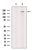 SPT6 Antibody in Western Blot (WB)