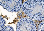 SRD5A2 Antibody in Immunohistochemistry (Paraffin) (IHC (P))