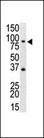 TLR4 Antibody in Western Blot (WB)