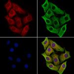 SIL Antibody in Immunocytochemistry (ICC/IF)