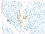 SIL Antibody in Immunohistochemistry (Paraffin) (IHC (P))