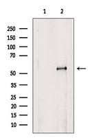 MST2 Antibody in Western Blot (WB)