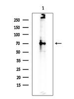 SPAK Antibody in Western Blot (WB)