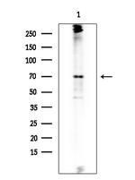 SPAK Antibody in Western Blot (WB)