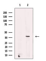 STRA8 Antibody in Western Blot (WB)