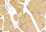 STRN4 Antibody in Immunohistochemistry (Paraffin) (IHC (P))