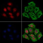 STS1 Antibody in Immunocytochemistry (ICC/IF)