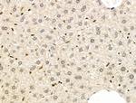 STS1 Antibody in Immunohistochemistry (Paraffin) (IHC (P))