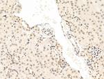 STS1 Antibody in Immunohistochemistry (Paraffin) (IHC (P))