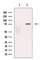 STS1 Antibody in Western Blot (WB)