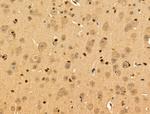 SUCLG1 Antibody in Immunohistochemistry (Paraffin) (IHC (P))