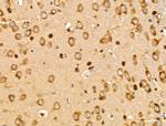 SUCLG1 Antibody in Immunohistochemistry (Paraffin) (IHC (P))