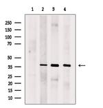 SUCLG1 Antibody in Western Blot (WB)