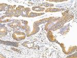 SULF1 Antibody in Immunohistochemistry (Paraffin) (IHC (P))