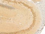 SULF1 Antibody in Immunohistochemistry (Paraffin) (IHC (P))