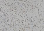 SUV39H1 Antibody in Immunohistochemistry (Paraffin) (IHC (P))