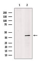 Synaptotagmin 5 Antibody in Western Blot (WB)