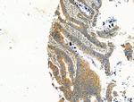 Syntrophin alpha-1 Antibody in Immunohistochemistry (Paraffin) (IHC (P))