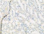 Syntrophin alpha-1 Antibody in Immunohistochemistry (Paraffin) (IHC (P))