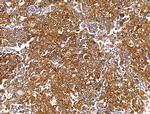 PLS3 Antibody in Immunohistochemistry (Paraffin) (IHC (P))