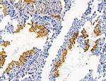 PLS3 Antibody in Immunohistochemistry (Paraffin) (IHC (P))