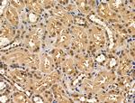 TBLR1 Antibody in Immunohistochemistry (Paraffin) (IHC (P))