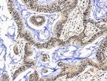 TBLR1 Antibody in Immunohistochemistry (Paraffin) (IHC (P))