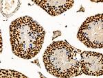 TBP Antibody in Immunohistochemistry (Paraffin) (IHC (P))