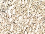 TBP Antibody in Immunohistochemistry (Paraffin) (IHC (P))