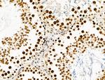 TBP Antibody in Immunohistochemistry (Paraffin) (IHC (P))