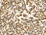 TBP Antibody in Immunohistochemistry (Paraffin) (IHC (P))