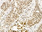 TBP Antibody in Immunohistochemistry (Paraffin) (IHC (P))