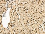 TBP Antibody in Immunohistochemistry (Paraffin) (IHC (P))