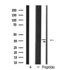 TBP Antibody in Western Blot (WB)